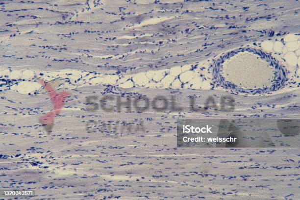 Prepared Microscope Slide - Striated Muscle: Skeletal